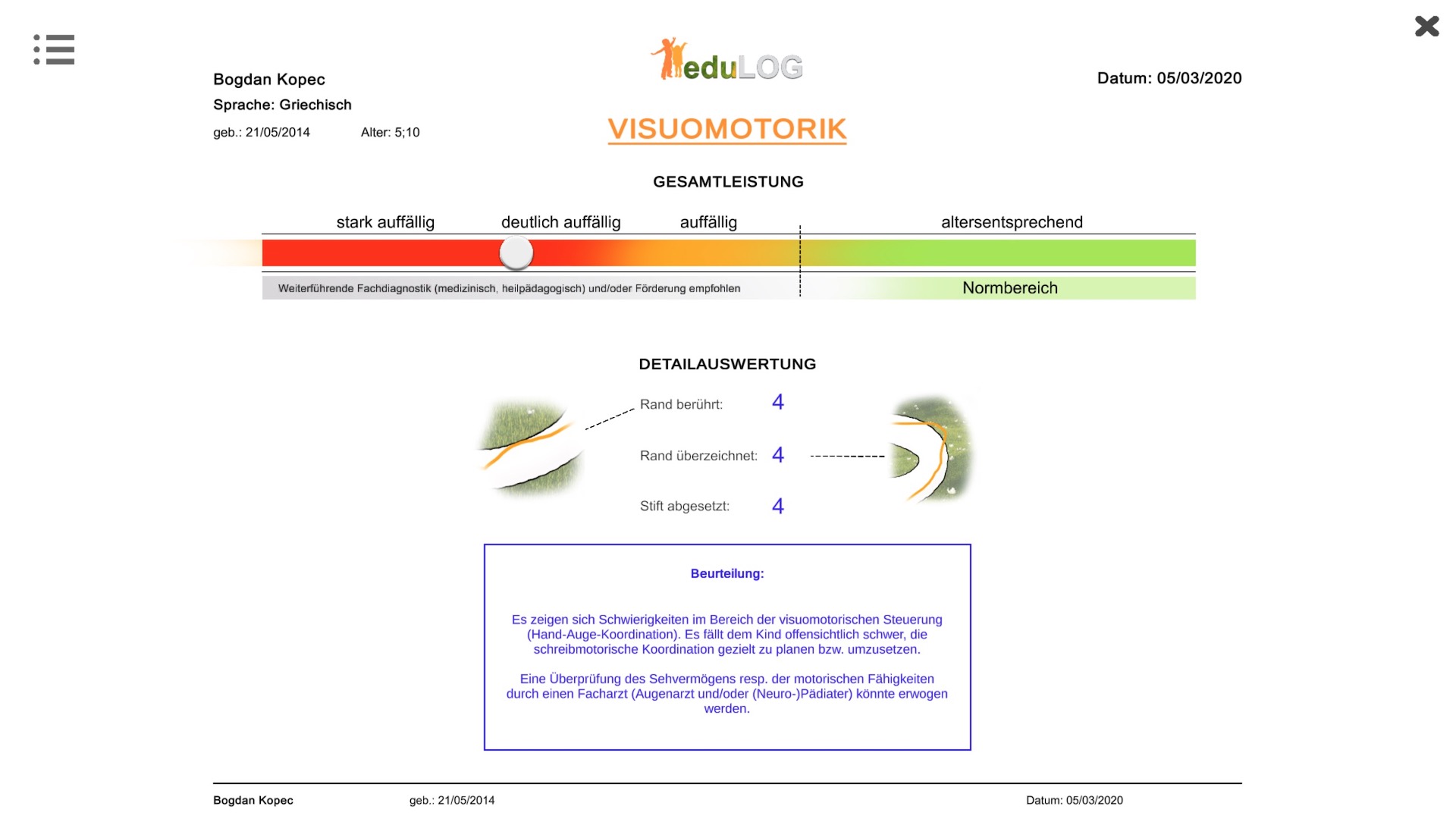 24%20 %20Auswertung%20(Visuomotorik)