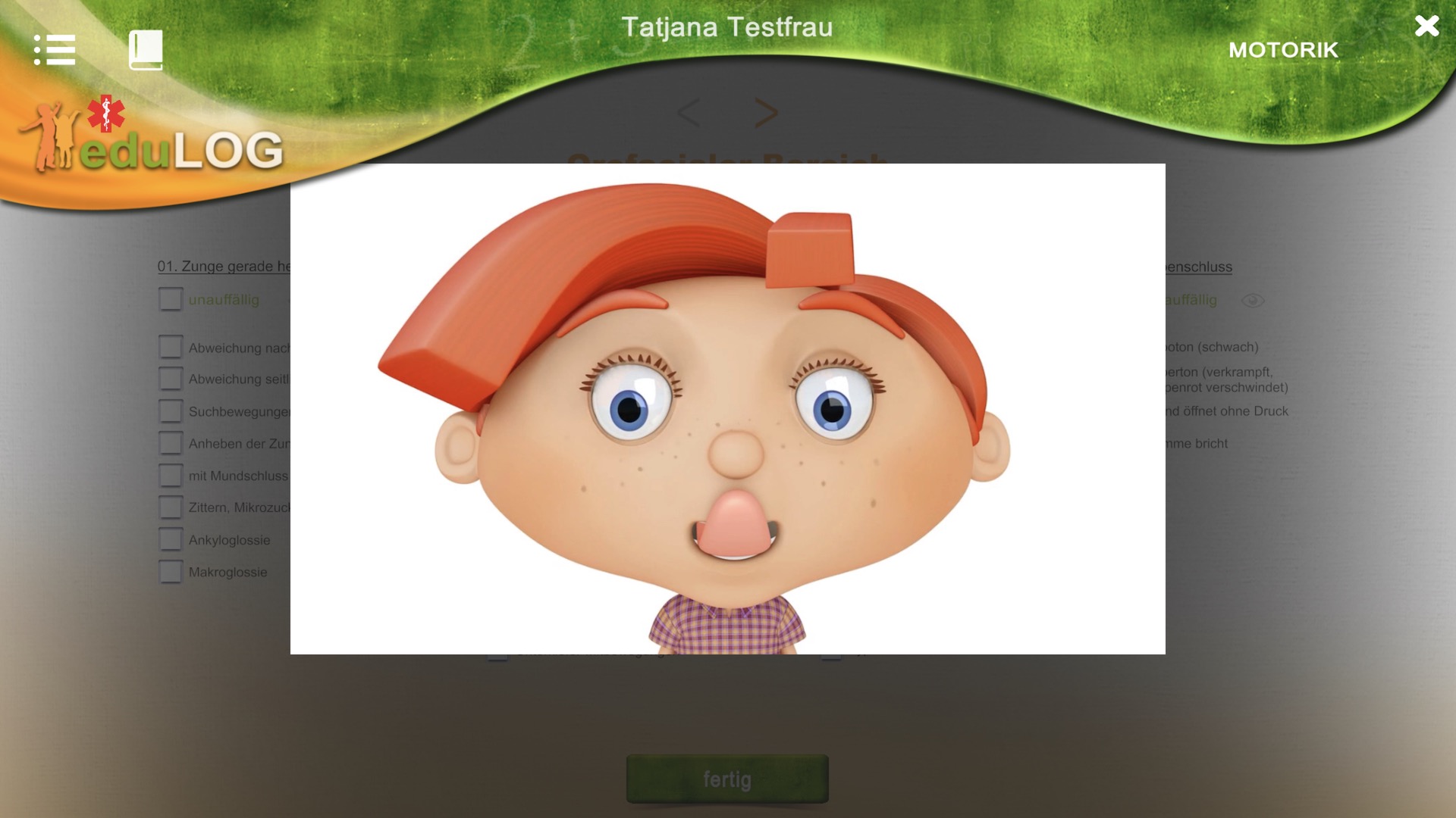 32%20 %20Motorik%20(orofacial)